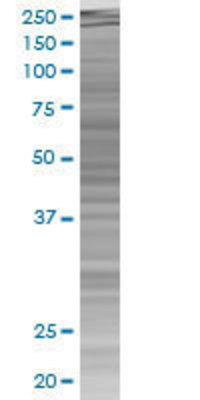 IL2RG transfected lysate.