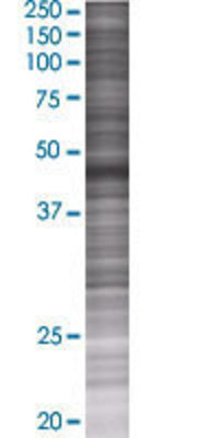 TRIM62 transfected lysate.