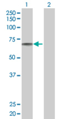 Lane 1: LBR transfected lysate (70.7 KDa) Lane 2: Non-transfected lysate.
