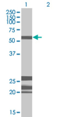 Lane 1: HDAC10 transfected lysate (73.7 KDa) Lane 2: Non-transfected lysate.