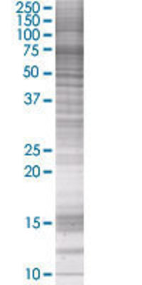 LBR transfected lysate.