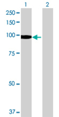 Lane 1: DIP2A transfected lysate (97.9 KDa) Lane 2: Non-transfected lysate.