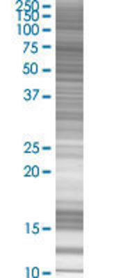 ZNFN1A2 transfected lysate.