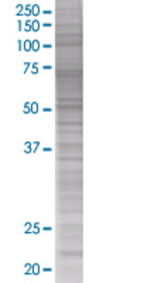 CD44 transfected lysate.