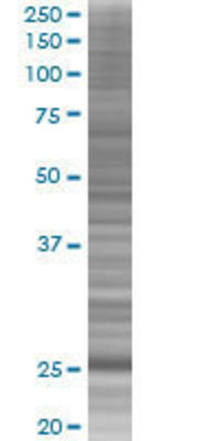 MXD3 transfected lysate.