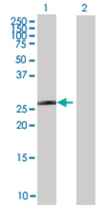 Lane 1: MXD3 transfected lysate (22.77 KDa) Lane 2: Non-transfected lysate.
