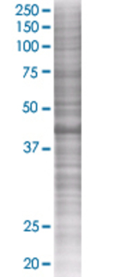 RAD51AP1 transfected lysate.