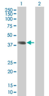 Lane 1: RAD51AP1 transfected lysate (36.96 KDa) Lane 2: Non-transfected lysate.