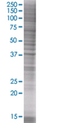 HEMK1 transfected lysate