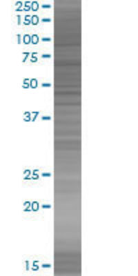 SLC26A2 transfected lysate.