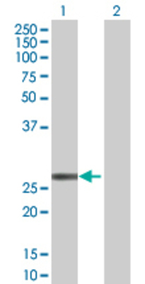 Lane 1: EIF4E transfected lysate (25.1 KDa) Lane 2: Non-transfected lysate.