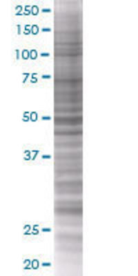 EIF4E transfected lysate.