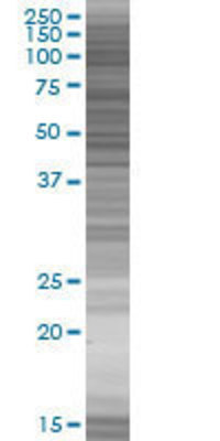 MIER1 transfected lysate.