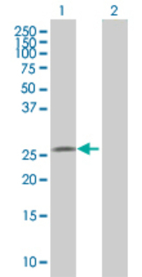 Lane 1: MIER1 transfected lysate (17.8 KDa) Lane 2: Non-transfected lysate.