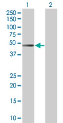 Lane 1: GNA15 transfected lysate (41.25 KDa). Lane 2: Non-transfected lysate.