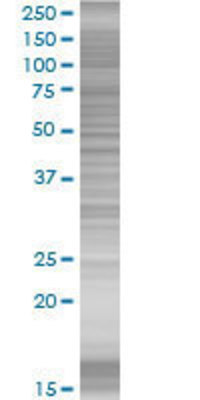 JUNB transfected lysate.