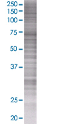 PAFAH1B3 transfected lysate.