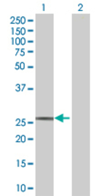 Lane 1: PAFAH1B3 transfected lysate (25.7 KDa) Lane 2: Non-transfected lysate.