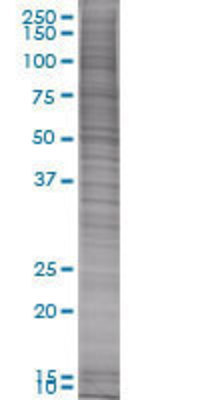 RGS18 transfected lysate