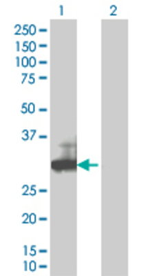 Lane 1: RGS18 transfected lysate (25.96 KDa). Lane 2: Non-transfected lysate.