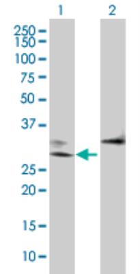 Western Blot: Adenine Nucleotide Translocator 2 Overexpression Lysate (Denatured) [H00000292-T01] - Lane 1: SLC25A5 transfected lysate (32.89 KDa). Lane 2: Non-transfected lysate.