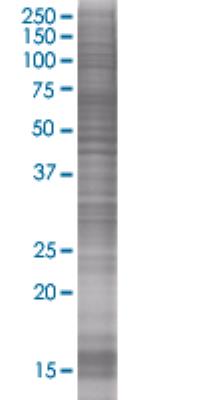 SDS-Page: Adenine Nucleotide Translocator 2 Overexpression Lysate (Denatured) [H00000292-T01] - SLC25A5 transfected lysate