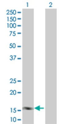 Lane 1: NUDT2 transfected lysate (16.8 KDa). Lane 2: Non-transfected lysate.
