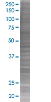NUDT2 transfected lysate