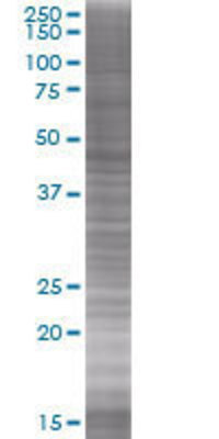 C18orf22 transfected lysate