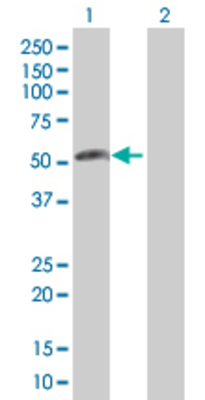 Lane 1: C18orf22 transfected lysate (37.84 KDa). Lane 2: Non-transfected lysate.