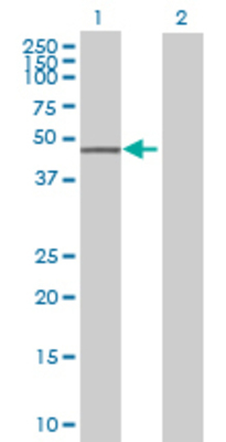 Lane 1: MGAT1 transfected lysate (49.06 KDa) Lane 2: Non-transfected lysate.