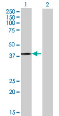 Lane 1: TGDS transfected lysate (38.61 KDa) Lane 2: Non-transfected lysate.