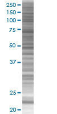 ATF3 transfected lysate.