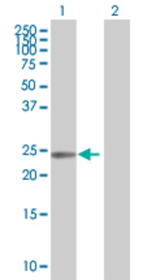 Lane 1: ATF3 transfected lysate (20.02 KDa) Lane 2: Non-transfected lysate.