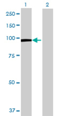 Lane 1: HLCS transfected lysate (79.97 KDa) Lane 2: Non-transfected lysate.