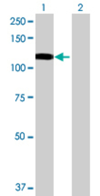 Lane 1: MANBA transfected lysate (96.8 KDa) Lane 2: Non-transfected lysate.