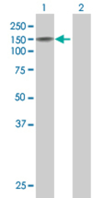 Lane 1: PARD3 transfected lysate (149.7 KDa) Lane 2: Non-transfected lysate.