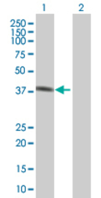Lane 1: PGC transfected lysate (42.4 KDa) Lane 2: Non-transfected lysate.