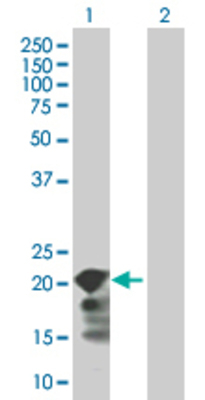 Lane 1: SELS transfected lysate (20.9 KDa). Lane 2: Non-transfected lysate.