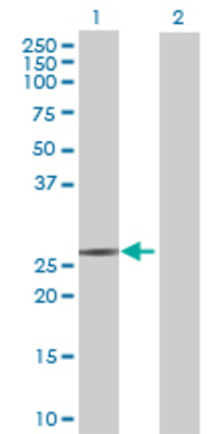 Lane 1: NANP transfected lysate (27.39 KDa) Lane 2: Non-transfected lysate.