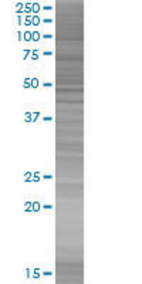 MYST1 transfected lysate.