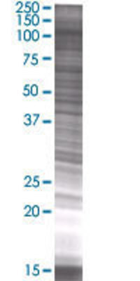BUB1 transfected lysate.