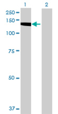 Lane 1: BUB1 transfected lysate (119.46 KDa) Lane 2: Non-transfected lysate.