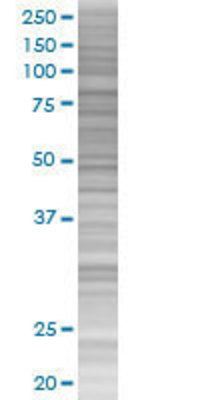 HCLS1 transfected lysate.