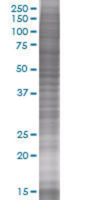 SFRS5 transfected lysate