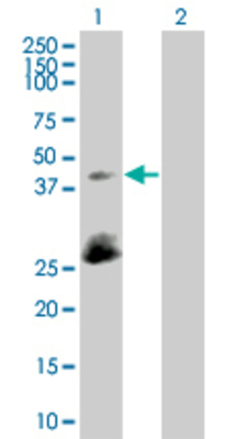 Lane 1: SFRS5 transfected lysate (30.03 KDa). Lane 2: Non-transfected lysate.
