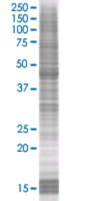 TRIM31 transfected lysate.