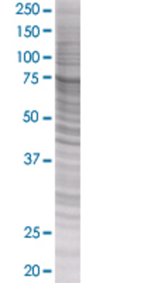 EIF4G1 transfected lysate.