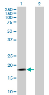 Lane 1: PIGH transfected lysate (20.79 KDa) Lane 2: Non-transfected lysate.
