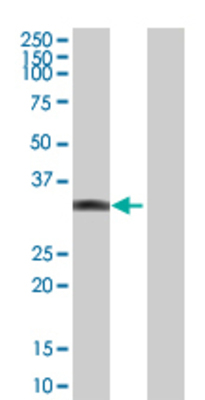 Lane 1: MPST transfected lysate (32.78 KDa) Lane 2: Non-transfected lysate.